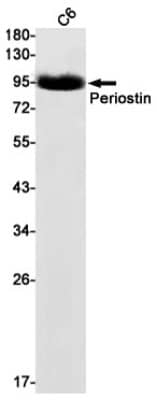 Western Blot: Periostin/OSF-2 Antibody (S03-7E3) [NBP3-20049]