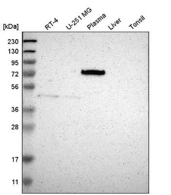 Western Blot: Periostin/OSF-2 Antibody [NBP1-82472]