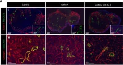 Immunohistochemistry: Peripheral Node Addressin Antibody (MECA-79) - Non-Recombinant Monoclonal [NB100-77673]