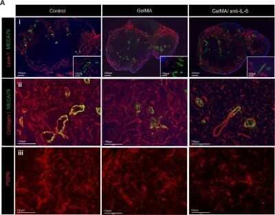 Immunohistochemistry: Peripheral Node Addressin Antibody (MECA-79R) - BSA Free [NBP2-78792]