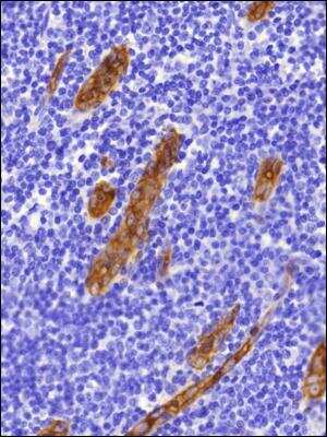 Immunohistochemistry-Paraffin: Peripheral Node Addressin Antibody (MECA-79R) - BSA Free [NBP2-78792]