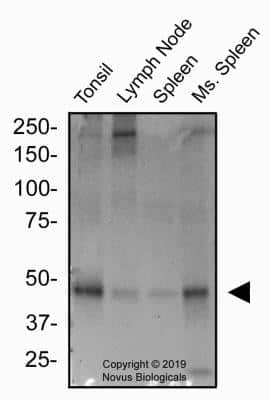 Western Blot: Peripheral Node Addressin Antibody (MECA-79R)BSA Free [NBP2-78792]