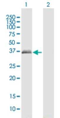 Western Blot: Peripherin 2/PRPH2 Antibody [H00005961-B01P]