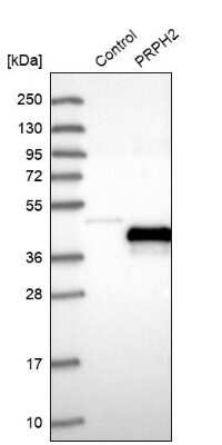 Western Blot: Peripherin 2/PRPH2 Antibody [NBP1-86687]