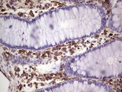 Immunohistochemistry: Peripherin Antibody (OTI1E10) [NBP2-45406]