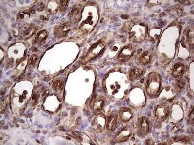 Immunohistochemistry: Peripherin Antibody (OTI1E10) [NBP2-45406]