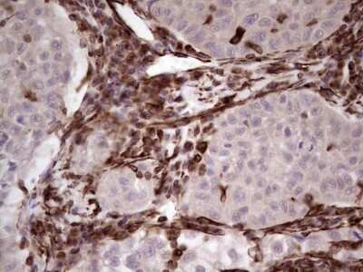 Immunohistochemistry: Peripherin Antibody (OTI1E10) [NBP2-45406]