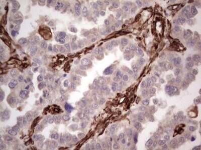 Immunohistochemistry: Peripherin Antibody (OTI1E10) [NBP2-45406]