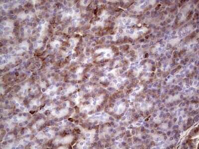 Immunohistochemistry: Peripherin Antibody (OTI1E10) [NBP2-45406]