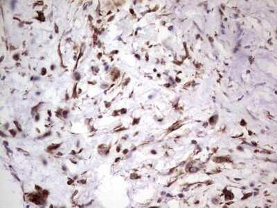 Immunohistochemistry: Peripherin Antibody (OTI1E10) [NBP2-45406]