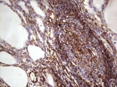 Immunohistochemistry: Peripherin Antibody (OTI1E10) [NBP2-45406]