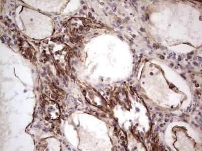 Immunohistochemistry: Peripherin Antibody (OTI1E10) [NBP2-45406]
