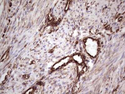 Immunohistochemistry: Peripherin Antibody (OTI1E10) [NBP2-45406]