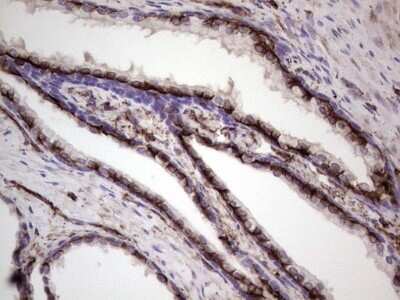 Immunohistochemistry: Peripherin Antibody (OTI1E10) [NBP2-45406]