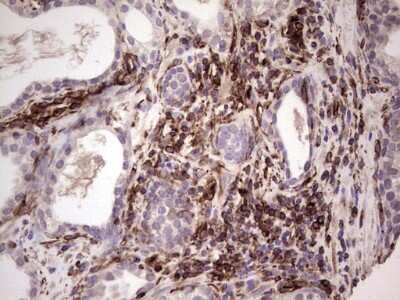 Immunohistochemistry: Peripherin Antibody (OTI1E10) [NBP2-45406]