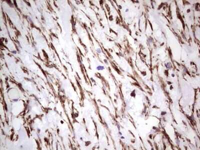Immunohistochemistry: Peripherin Antibody (OTI1E10) [NBP2-45406]