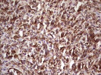 Immunohistochemistry: Peripherin Antibody (OTI1E10) [NBP2-45406]