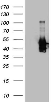 Western Blot: Peripherin Antibody (OTI1E10) [NBP2-45406]