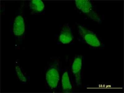 Immunocytochemistry/ Immunofluorescence: Peripherin Antibody (3B3) [H00005630-M02]
