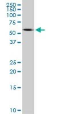 Western Blot: Peripherin Antibody (3B3) [H00005630-M02]