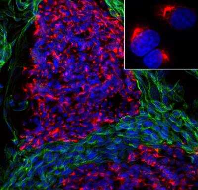 Immunocytochemistry/ Immunofluorescence: Peripherin Antibody (7C5) [NB300-220]