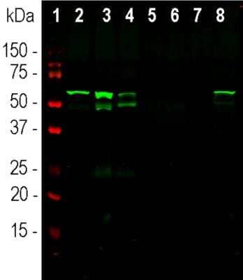 Western Blot: Peripherin Antibody (7C5) [NB300-220]