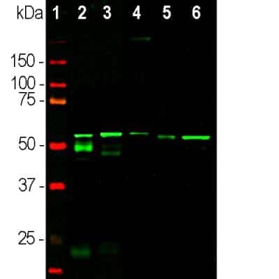 Western Blot: Peripherin Antibody (8G2) [NB300-138]