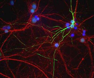 Immunocytochemistry/ Immunofluorescence: Peripherin Antibody [NB300-137]