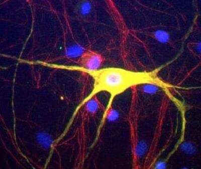 Immunocytochemistry/ Immunofluorescence: Peripherin Antibody [NBP1-05423]