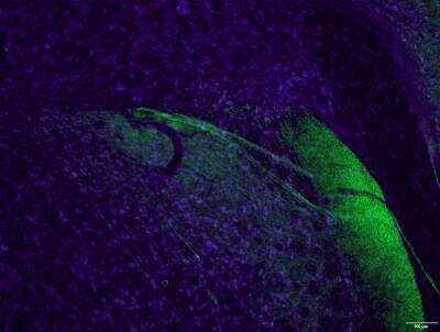 Immunohistochemistry-Frozen: Peripherin Antibody [NBP1-05423]