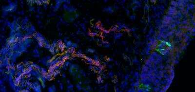 Immunohistochemistry-Frozen: Peripherin Antibody [NBP1-05423]