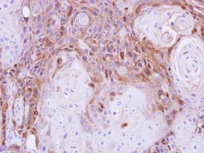 Immunohistochemistry-Paraffin: Peripherin Antibody [NBP2-19774]