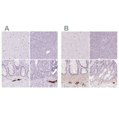 Immunohistochemistry-Paraffin: Peripherin Antibody [NBP2-38444]