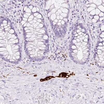 Immunohistochemistry-Paraffin: Peripherin Antibody [NBP2-38444]