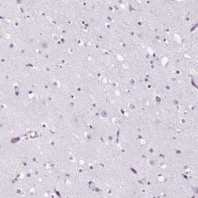 Immunohistochemistry-Paraffin: Peripherin Antibody [NBP2-38444]