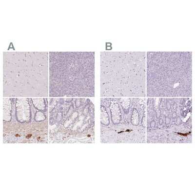 Immunohistochemistry-Paraffin: Peripherin Antibody [NBP2-39008]