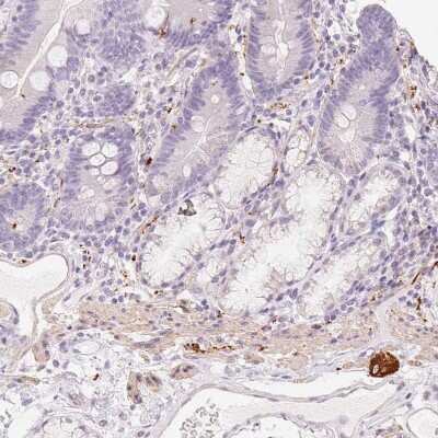 Immunohistochemistry-Paraffin: Peripherin Antibody [NBP2-39008]