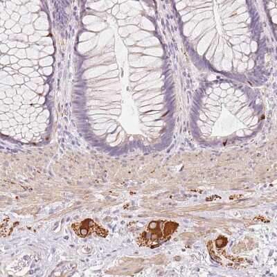 Immunohistochemistry-Paraffin: Peripherin Antibody [NBP2-39008]
