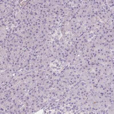 Immunohistochemistry-Paraffin: Peripherin Antibody [NBP2-39008]