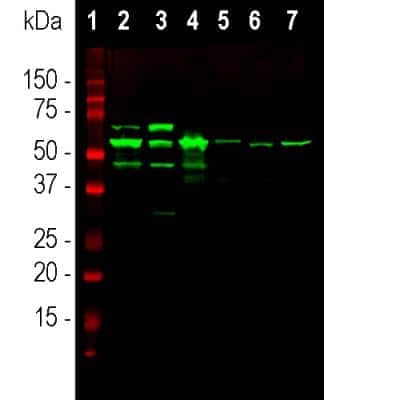 Western Blot: Peripherin Antibody [NB300-137]