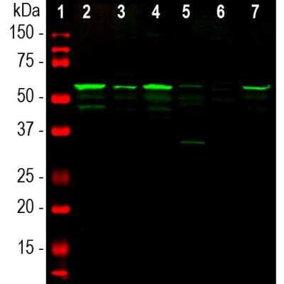 Western Blot: Peripherin Antibody [NBP1-05423]