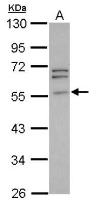 Western Blot: Peripherin Antibody [NBP2-19774]