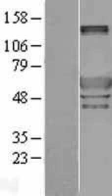 Western Blot: Peripherin Overexpression Lysate [NBL1-14825]