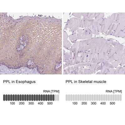 Immunohistochemistry-Paraffin: Periplakin Antibody [NBP2-13795]