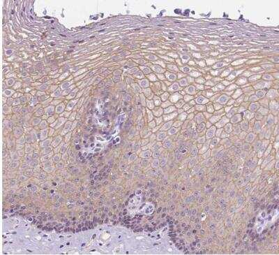 Immunohistochemistry-Paraffin: Periplakin Antibody [NBP2-13795]