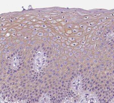 Immunohistochemistry-Paraffin: Periplakin Antibody [NBP2-13795]