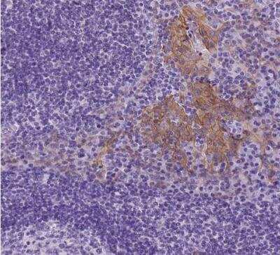Immunohistochemistry-Paraffin: Periplakin Antibody [NBP2-13795]