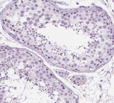 Immunohistochemistry-Paraffin: Periplakin Antibody [NBP2-13795]