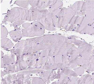 Immunohistochemistry-Paraffin: Periplakin Antibody [NBP2-13795]
