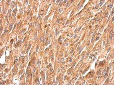 Immunohistochemistry-Paraffin: Periplakin Antibody [NBP2-19775]